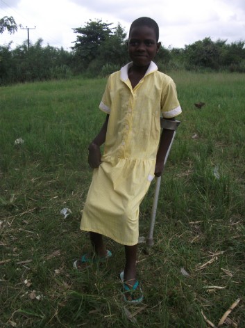 a little gir suffering from Buruli Ulcer in the Ga South District